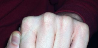 Ventspilī agresīvs vīrietis iesit pa seju policistam