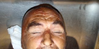 Policija lūdz palīdzību vīrieša atpazīšanā!